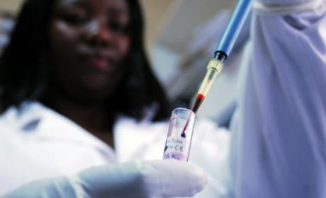 Nurse conducts C4 count test for HIV, Bobete clinic. Photo: Irish Aid